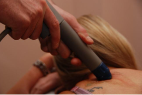 shockwave-treatment-stafford